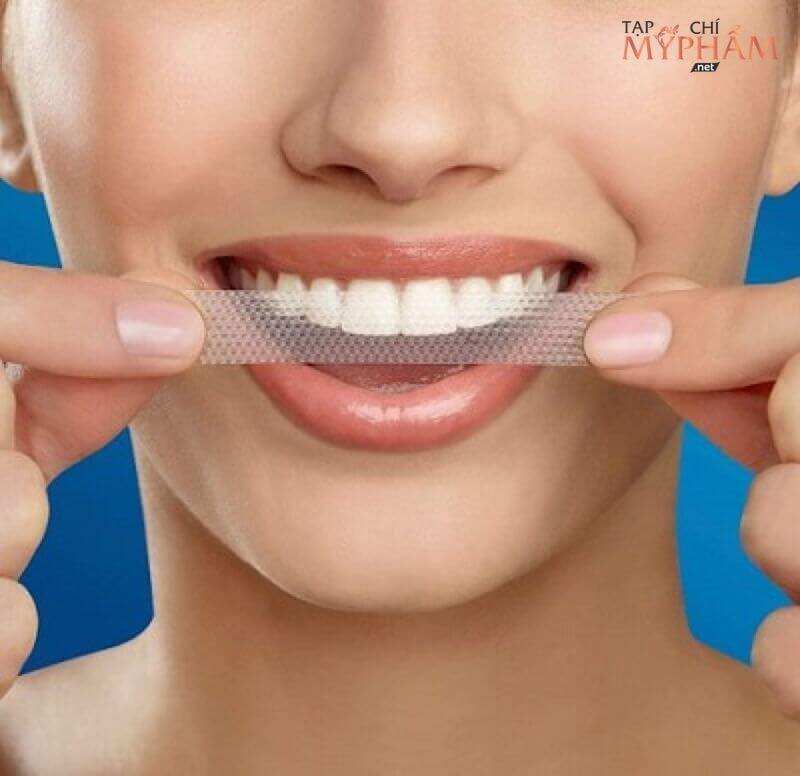 Miếng dán trắng răng có tốt không? Review chi tiết 11 miếng dán trắng răng được ưu chuộng nhất hiện nay