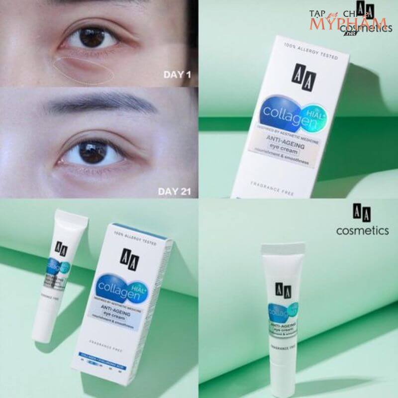 Review kem dưỡng mắt AA Collagen Hial+ của AA Cosmetics đánh bay quầng thâm mắt hiệu quả nhất hiện nay